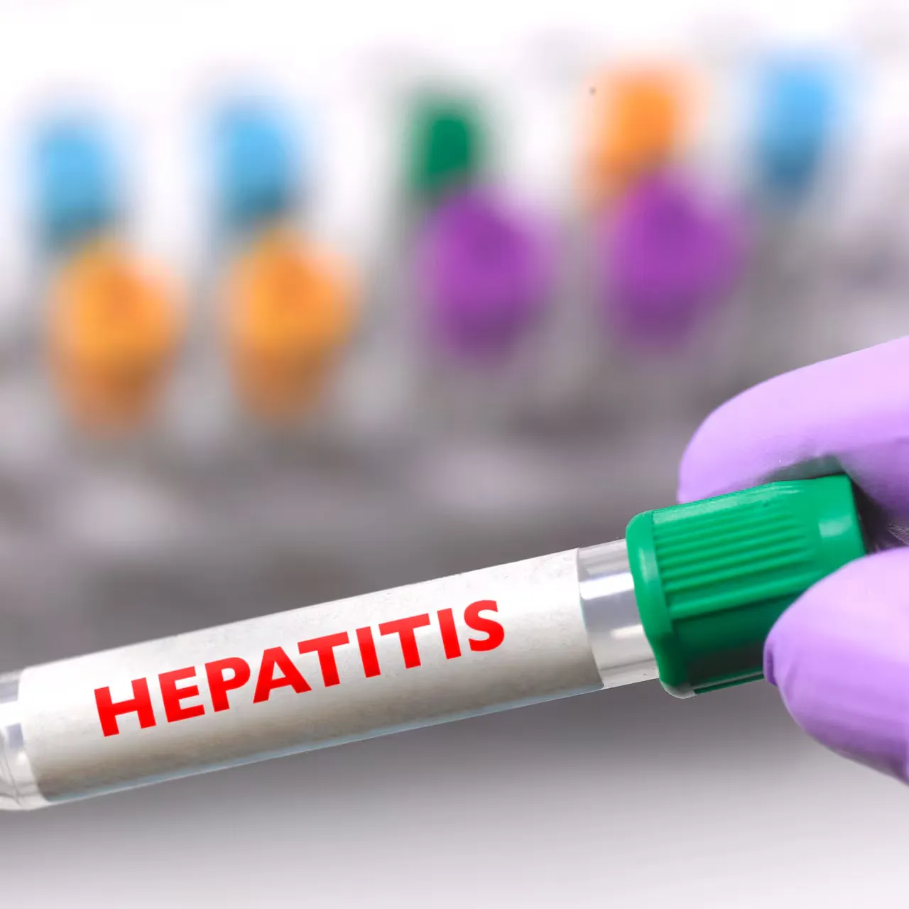 Hepatitis
